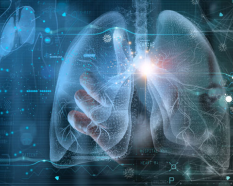 AI Tool Elicits Enthusiasm Among Scientists for Its Ability to Assess the Severity of Rare Cancer Cases