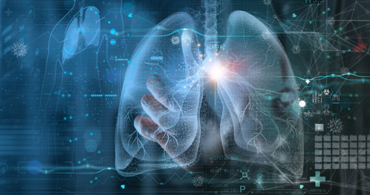 AI Tool Elicits Enthusiasm Among Scientists for Its Ability to Assess the Severity of Rare Cancer Cases