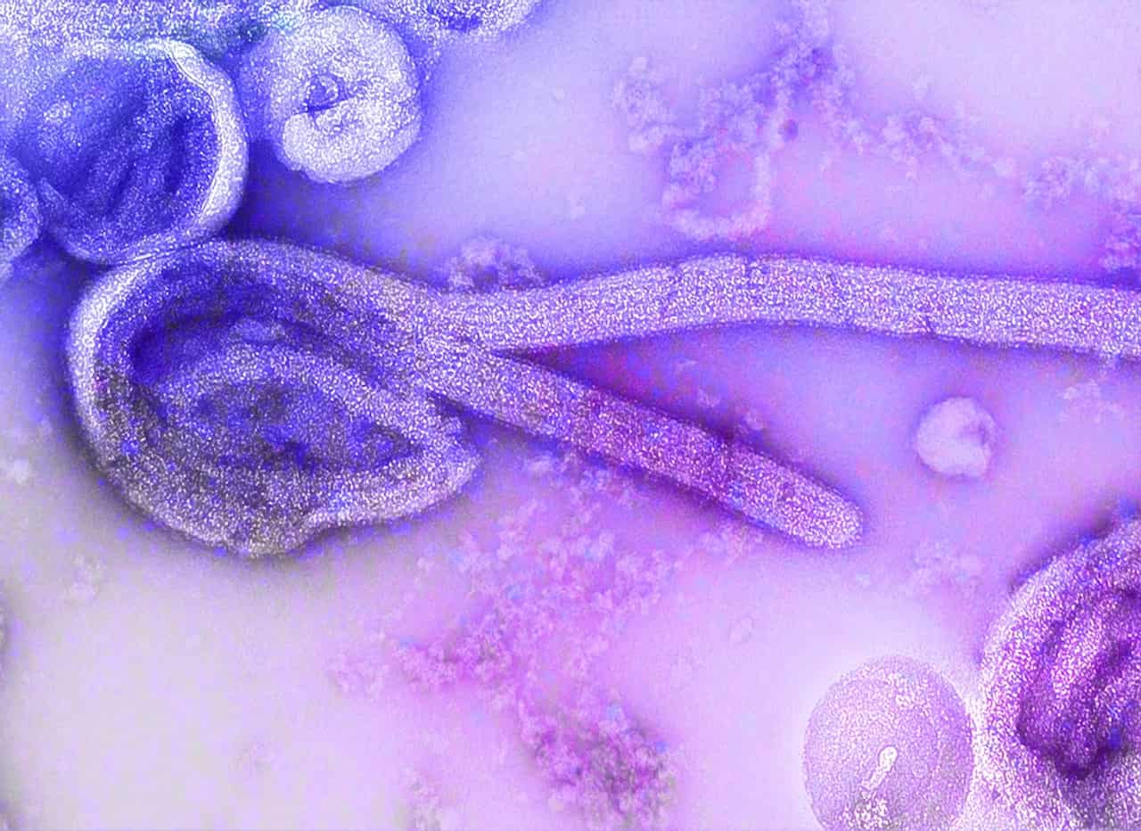 Ebola outbreak funding response