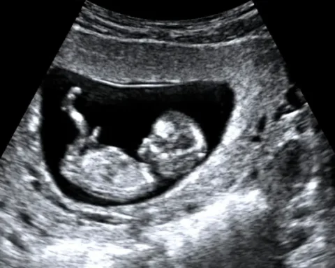 Britain’s unregulated scan clinics ‘putting lives at risk’