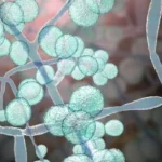 Candida auris becomes more infectious and spreads globally, study warns
