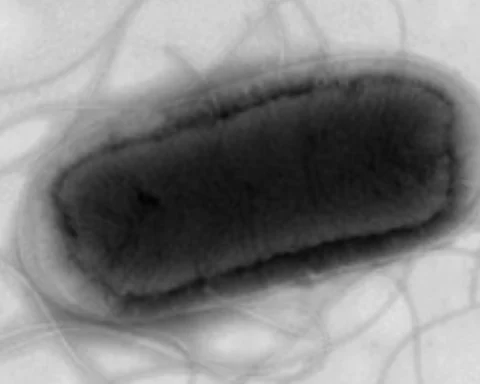 E. Coli Warning Issued as Cases Surge