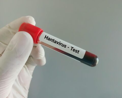 hantavirus symptoms warning issued during remote Pacific island investigation in 2026