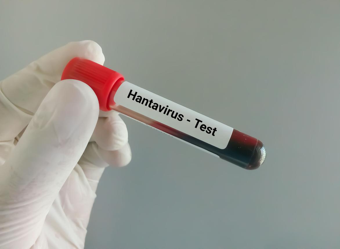 hantavirus symptoms warning issued during remote Pacific island investigation in 2026