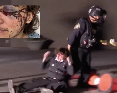 Second anti-ICE protester blinded by Federal projectile during Santa Ana demonstration