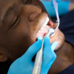 Six Crucial Signs of Mouth Cancer You Mustn't Overlook Amid Rising UK Cases, According to Experts