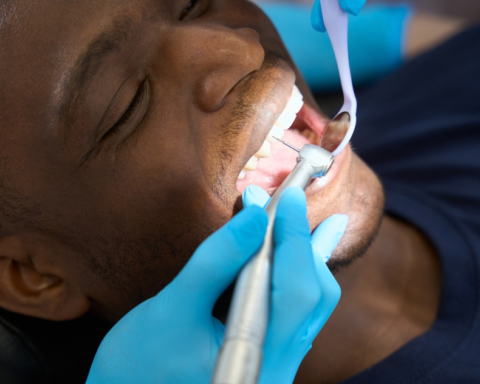 Six Crucial Signs of Mouth Cancer You Mustn't Overlook Amid Rising UK Cases, According to Experts