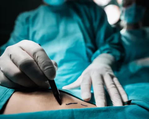 Streeting issues warning on the dangers of low-price cosmetic surgery abroad
