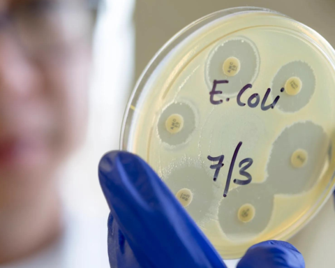 UKHSA Issues Warning E-coli Outbreak Surpasses 100 Cases