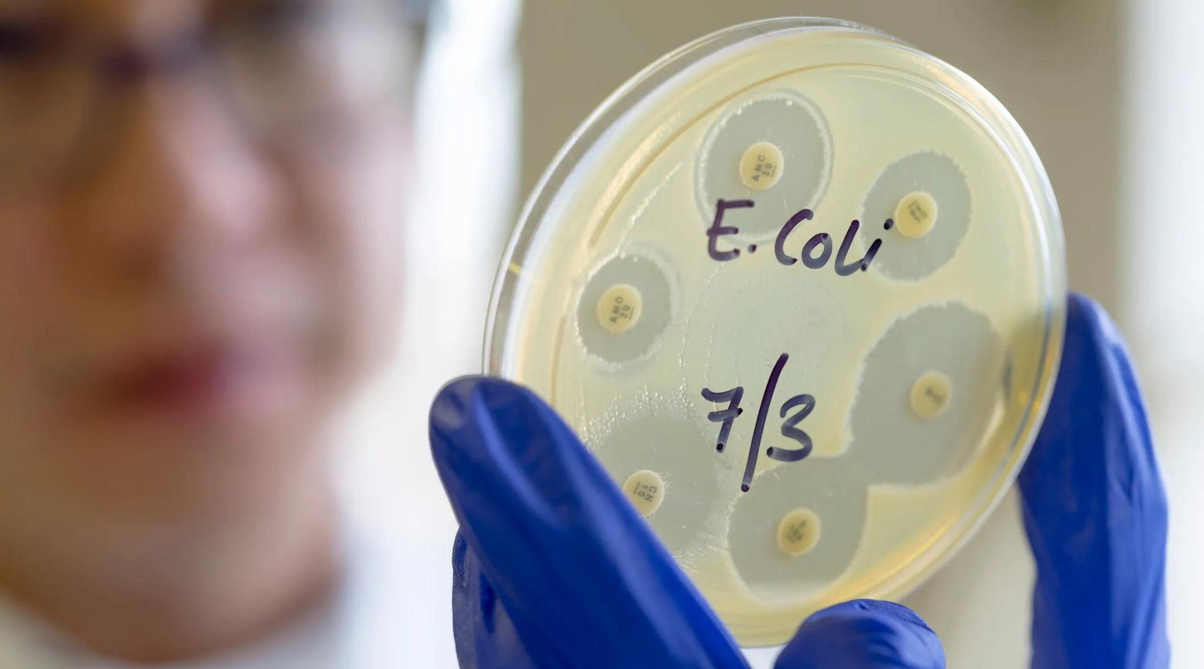 UKHSA Issues Warning E-coli Outbreak Surpasses 100 Cases