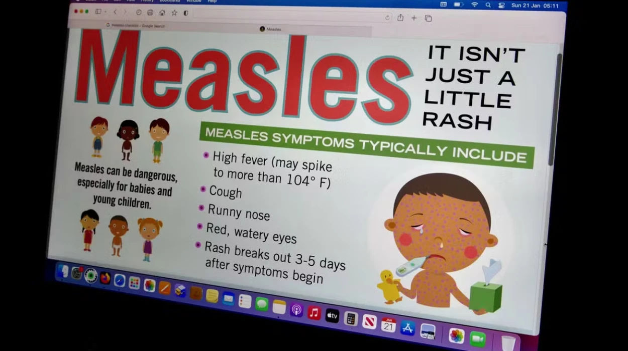 Why is Measles Making a Comeback in the UK